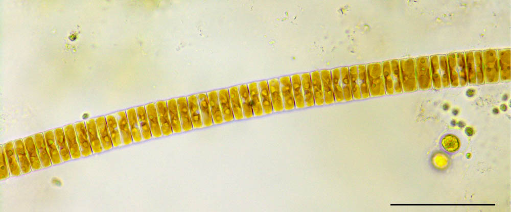 フラギラリア (Fragilaria sp.）の画像