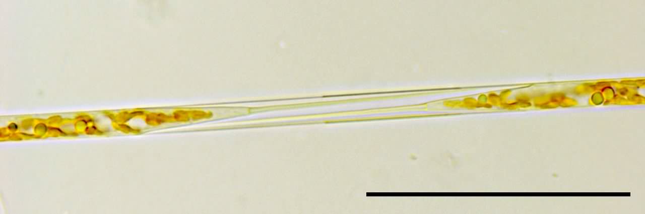 リゾソレニア （Rhizosolenia sp.）の画像