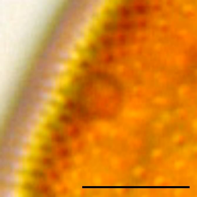 アクティノキクラス (Actinocyclus octonarius）の画像