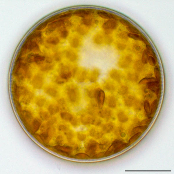 アクティノキクラス (Actinocyclus octonarius）の画像