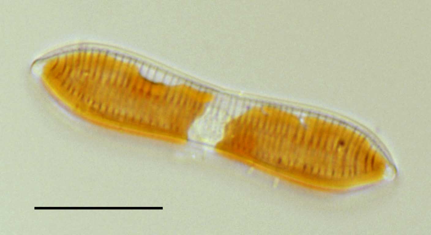 トリブリオネラ（Tryblionella sp.）の画像