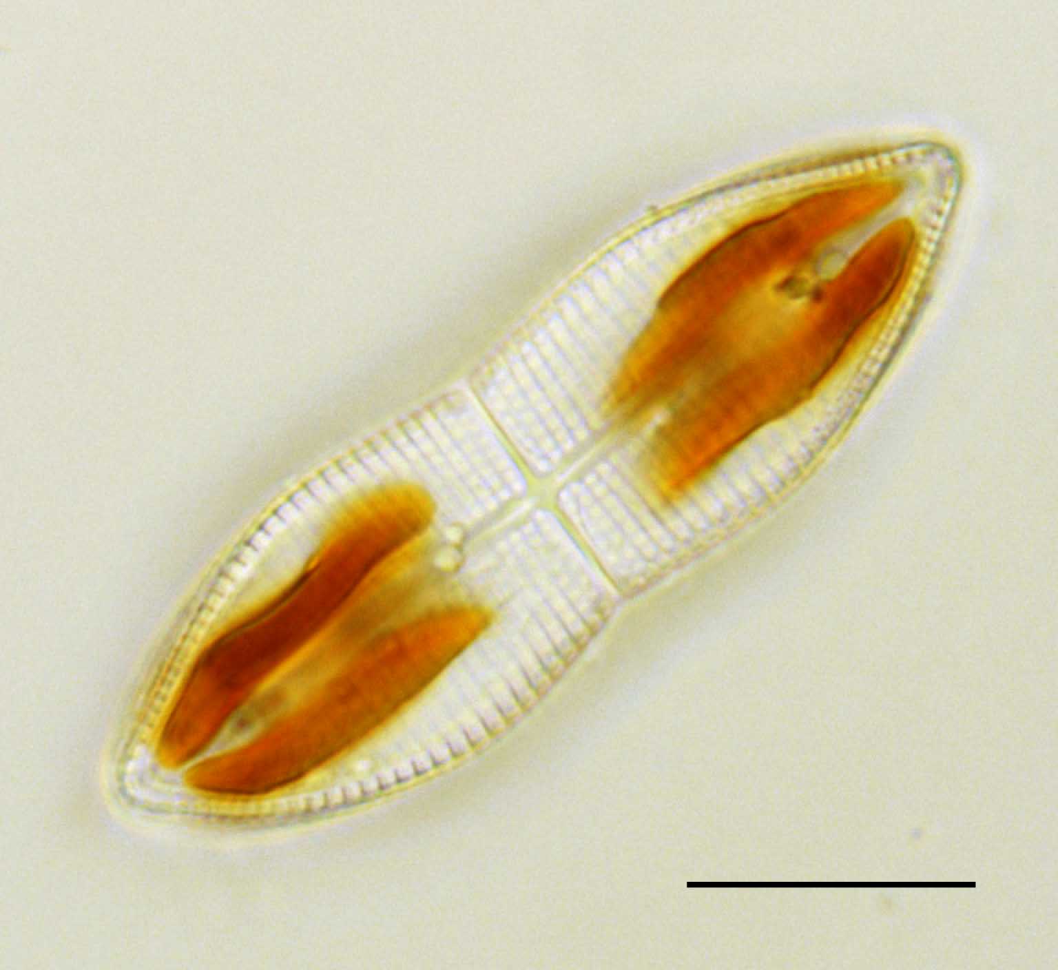 アクナンテス(Achnanthes longipes)の画像