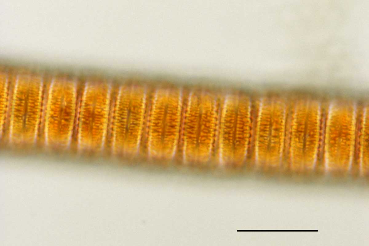 パラリア(Paralia sp.)の画像
