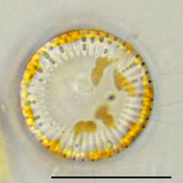 ヒメマルケイソウ(Cyclotella sp.)の画像