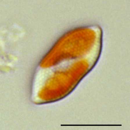 プサムディクチオン（Psammodictyon sp.）の画像