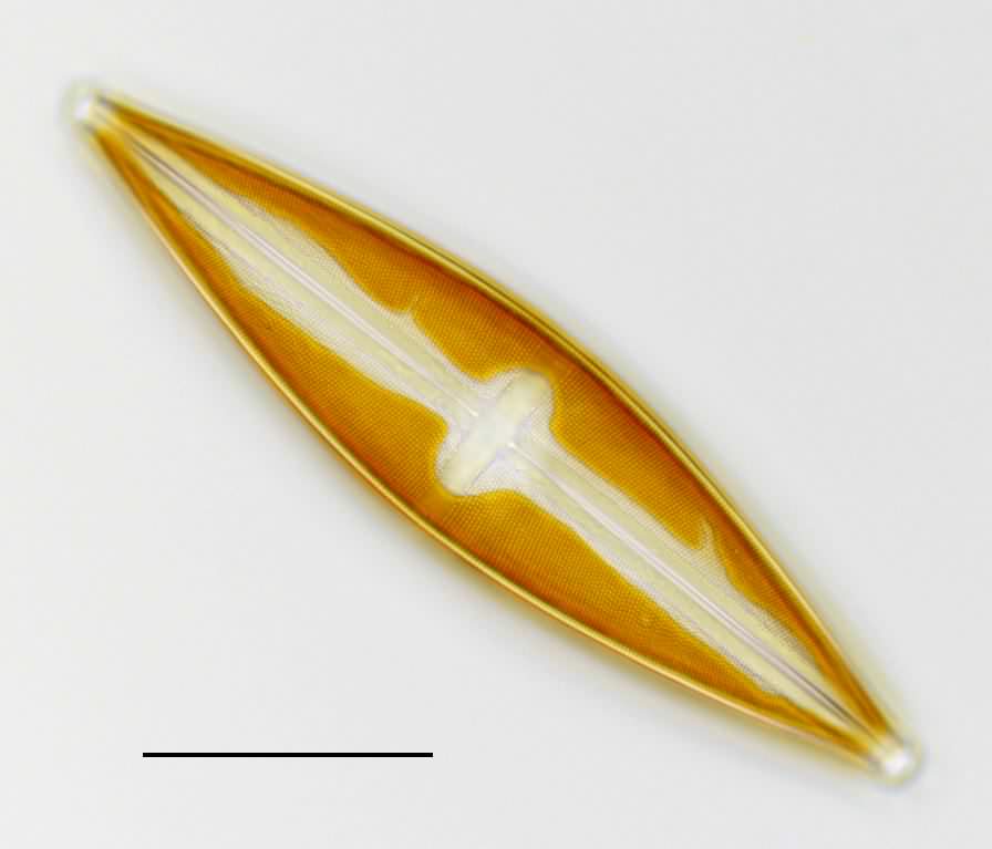 スタウロネイス（Stauroneis）の画像
