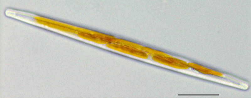 クサリケイソウ （Bacillaria sp.）の画像