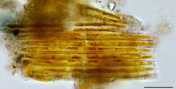 クサリケイソウ （Bacillaria sp.）の画像