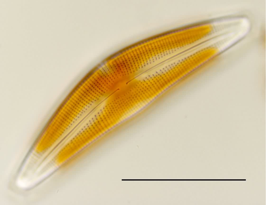 クチビルケイソウ (Cymbella sp.)の画像