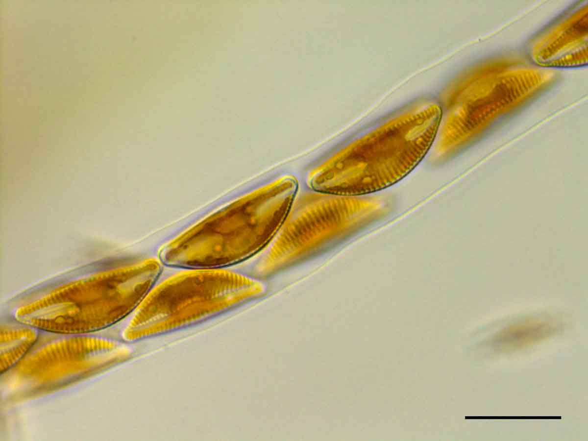 エンシオネマ（Encyonema sp.)の画像
