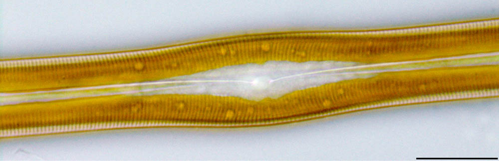 ハネケイソウ（Pinnularia）の画像