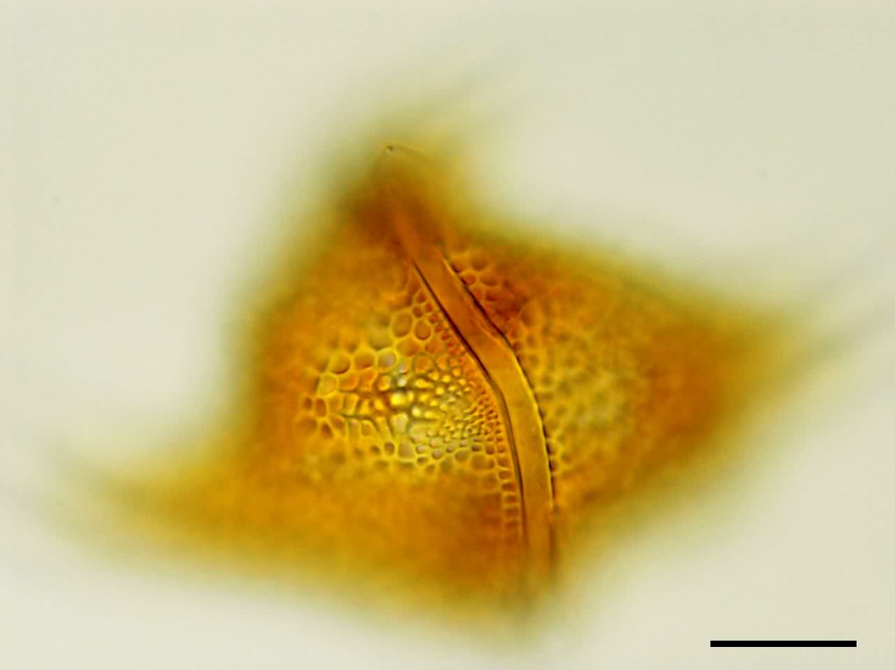 ヌマツノオビムシ （Ceratium cornutum）の画像