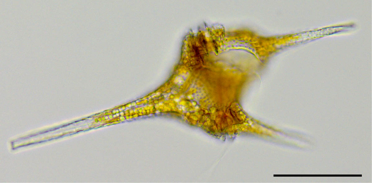 イケツノツノオビムシ（Ceratium hirundinella）の画像