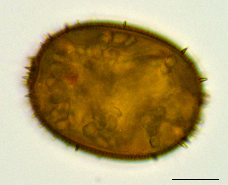 カラヒゲムシ（Trachelomonas sp.）の画像