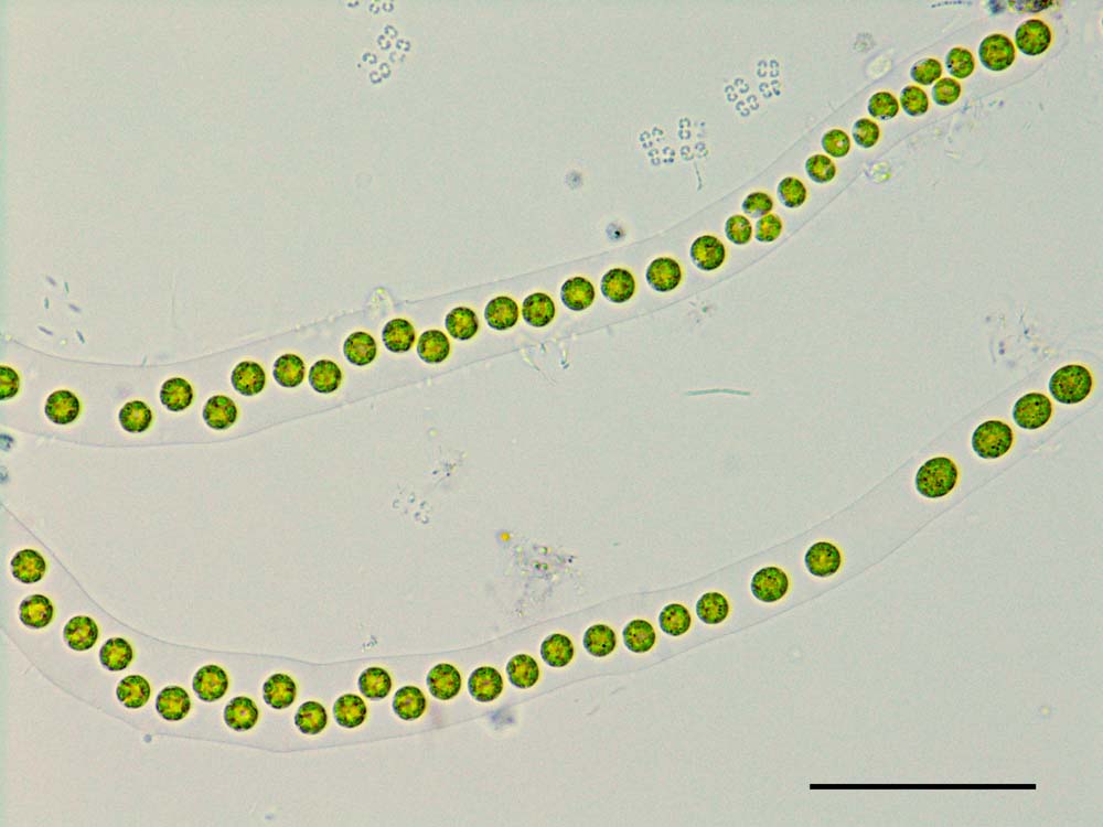 パルモディクチオン （Palmodictyon sp.） の画像