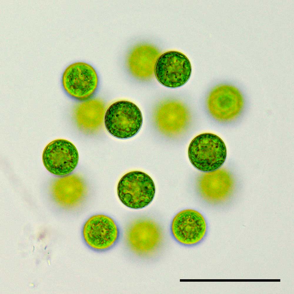 スフェロキスチス（cf. Sphaerocystis sp.）の画像