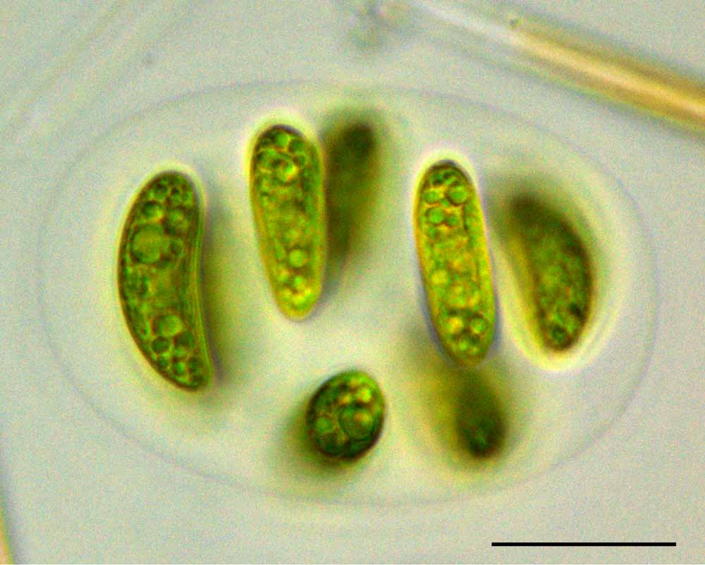 ネフロキティウム（Nephrocytium sp.）の画像