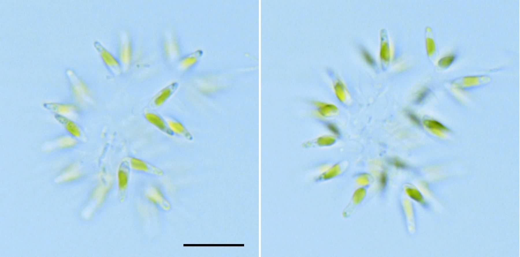 ディコトモコックス? (cf. Dichotomococcus sp.) の画像