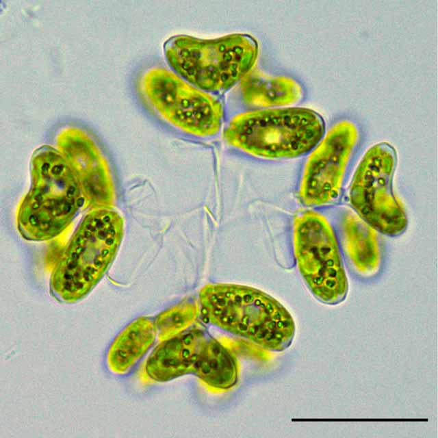 ディモルフォコックス（Dimorphococcus sp.）の画像
