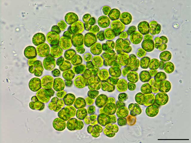 テトラキスティス （cf. Tetracystis sp.） の画像
