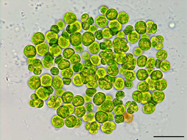 テトラキスティス （cf. Tetracystis sp.） の画像