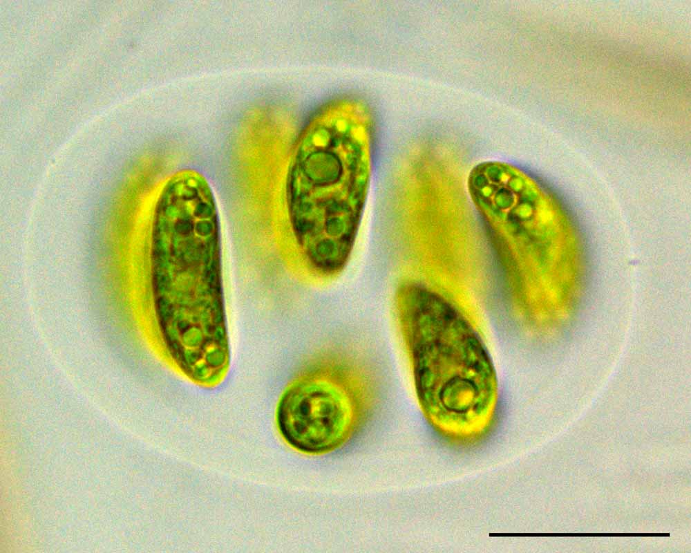 ネフロキティウム（Nephrocytium sp.）の画像