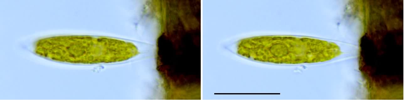 カラシウム （Characium sp.）の画像