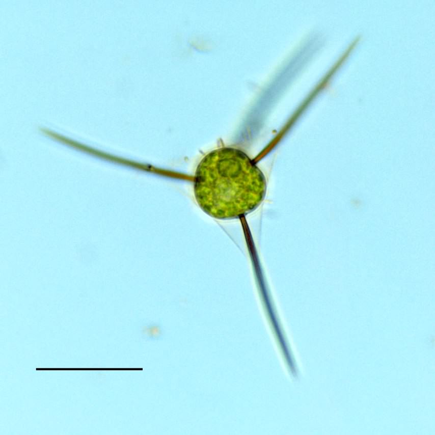 エキノスファエリジウム　（Echinosphaeridium sp.）の画像