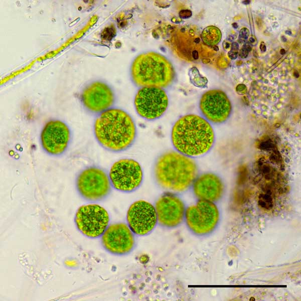 アステロコックス （Asterococcus sp.）の画像