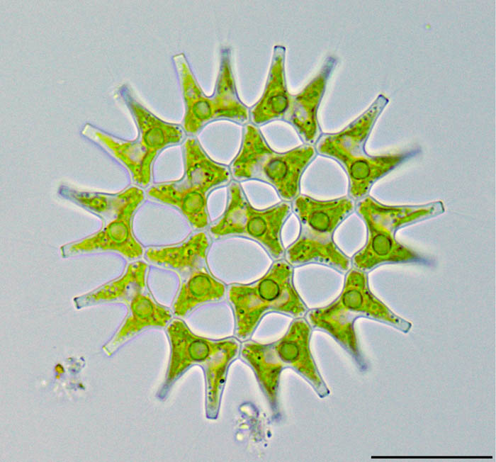 フタヅノクンショウモ（Pediastrum duplex var. gracillimum）の画像