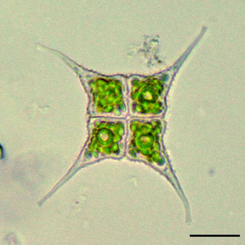 ヒトヅノクンショウモ （Pediastrum simplex var. echinulatum）の画像