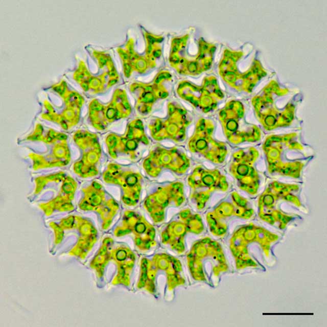 アミメクンショウモ （Pediastrum araneosum）の画像