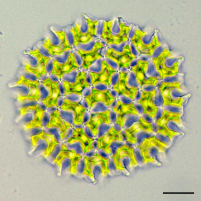 アミメクンショウモ （Pediastrum araneosum）の画像
