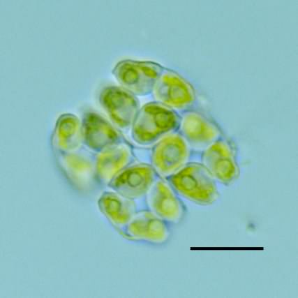 クルキゲニエラ（Crucigeniella sp.）の画像