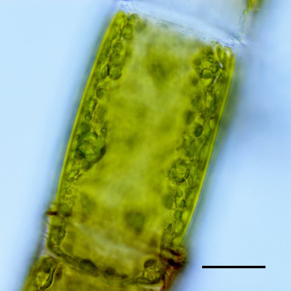 サヤミドロ （Oedogonium sp.）の画像