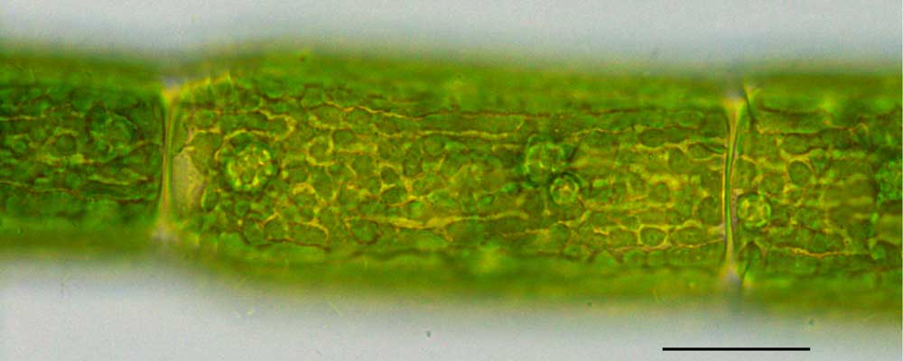 サヤミドロ （Oedogonium sp.）の画像
