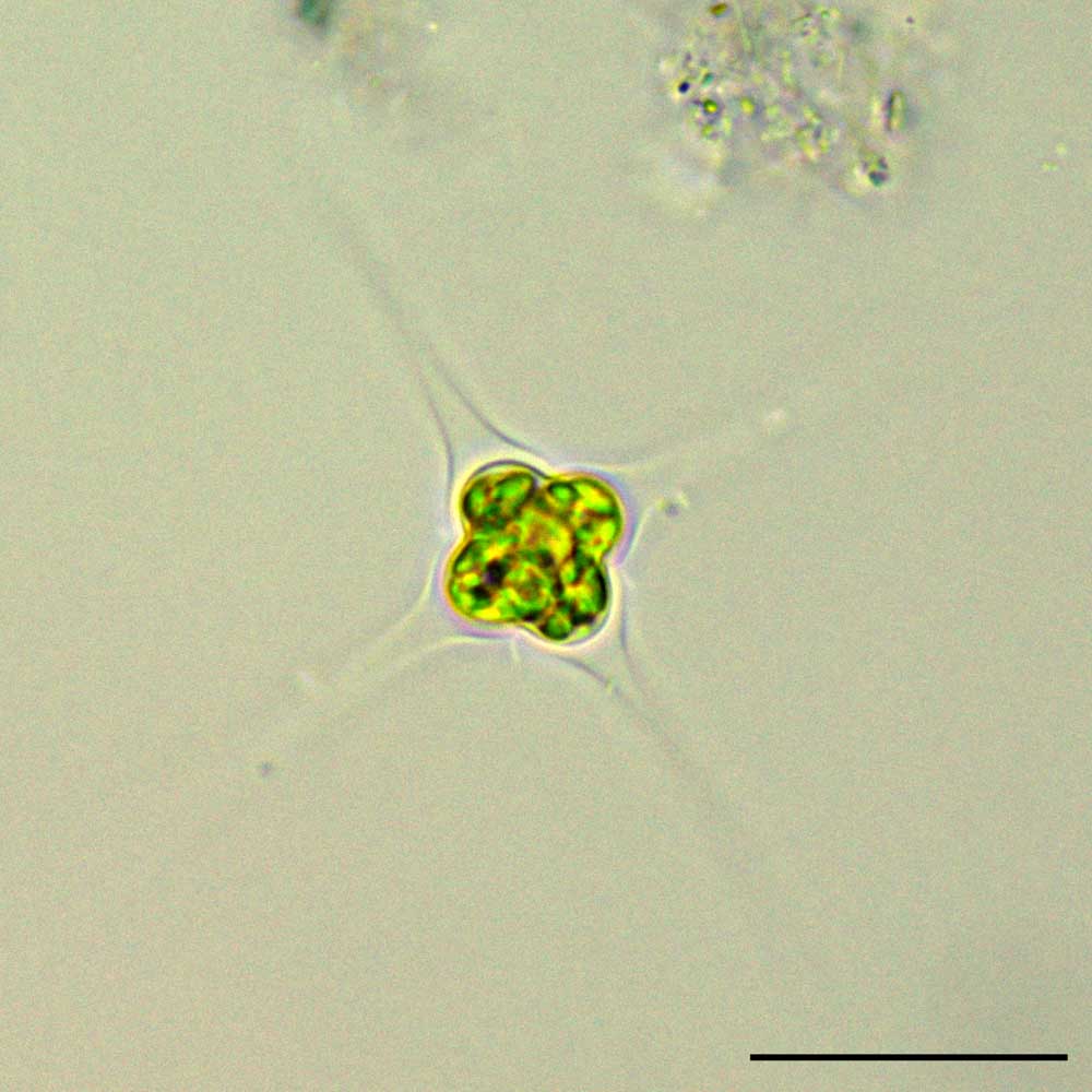 トレウバリア　（Treubaria sp.）の画像