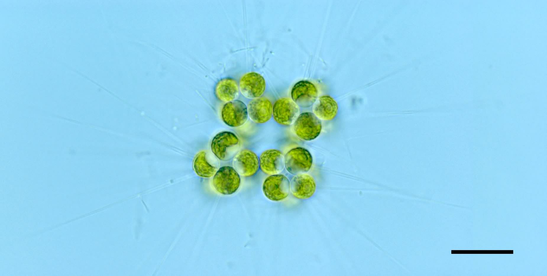 ミクラクチニウム （Micractinium sp.） の画像