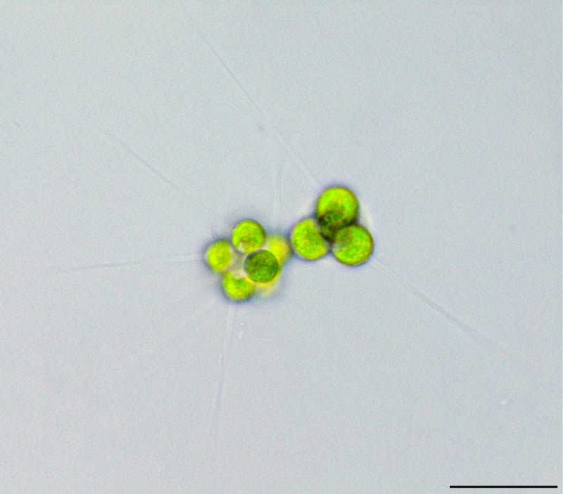 ミクラクチニウム （Micractinium sp.） の画像