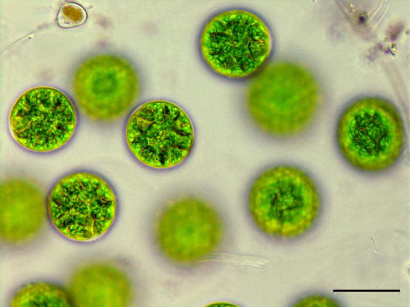 アステロコックス （Asterococcus sp.）の画像