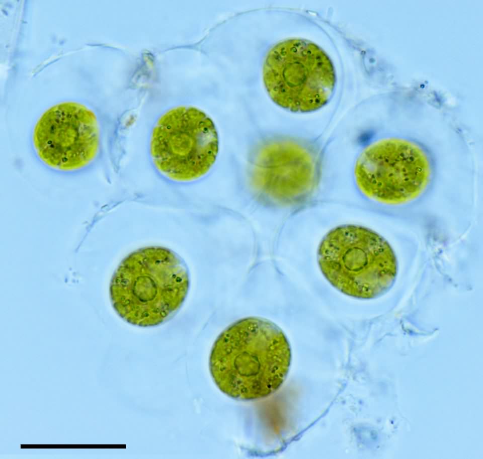 グロエオキスチス （Gloeocystis sp.）の画像