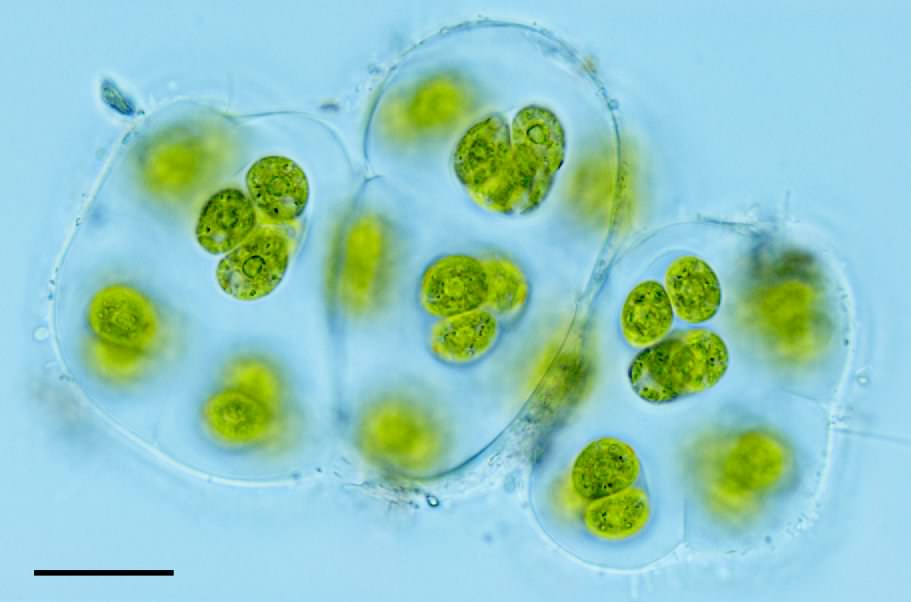 グロエオキスチス （Gloeocystis sp.）の画像