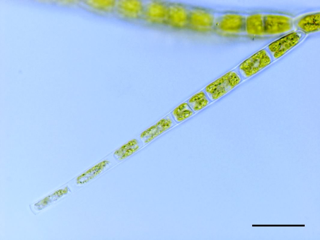スティゲオクロニウム（Stigeoclonium sp.）の画像