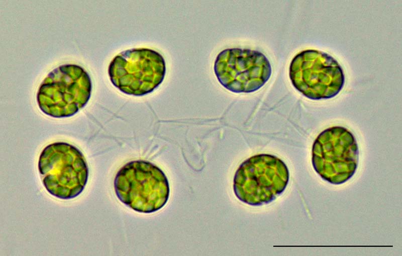 ディクチオスフェリウム　（Dictyosphaerium sp.）の画像