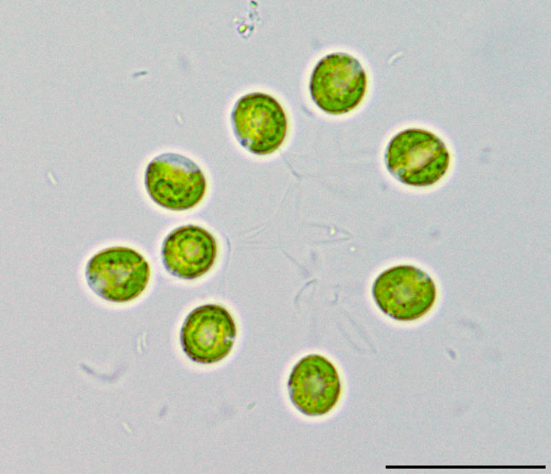 ディクチオスフェリウム　（Dictyosphaerium sp.）の画像