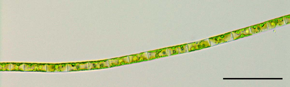 ヒビミドロ （Ulothrix sp.）の画像