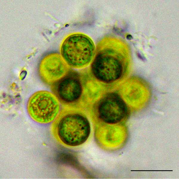 スフェロキスチス？ （cf. Sphaerocystis sp.） の画像