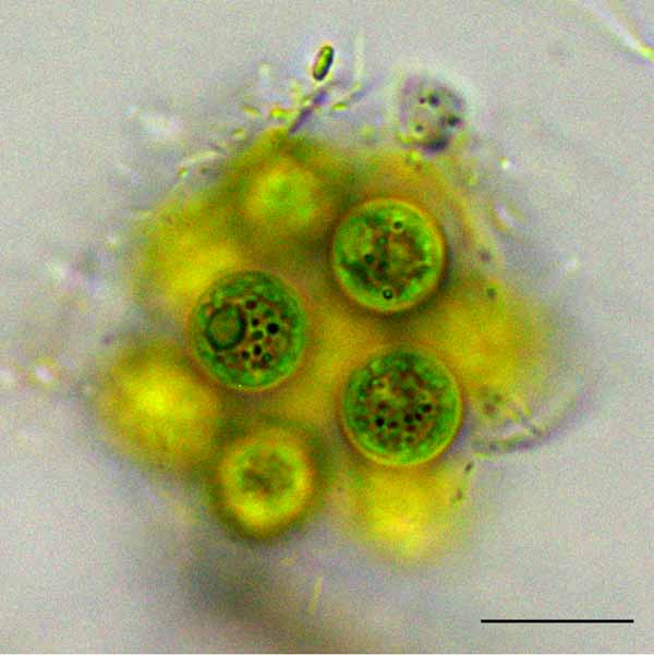 スフェロキスチス？ （cf. Sphaerocystis sp.） の画像