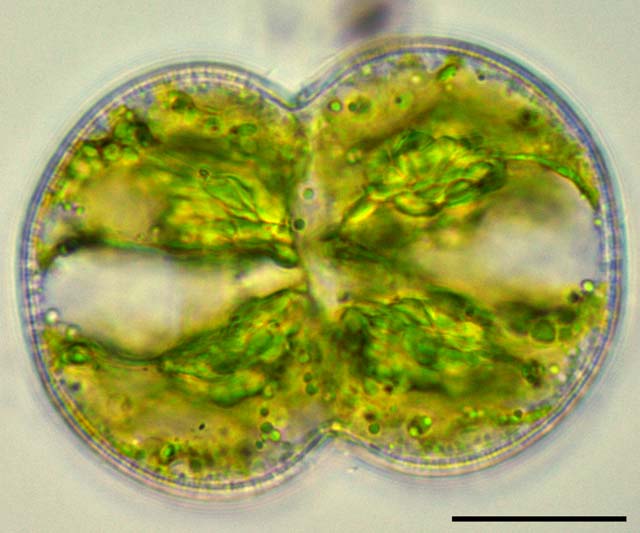 アクチノテニウム （Actinotaenium sp.）の画像