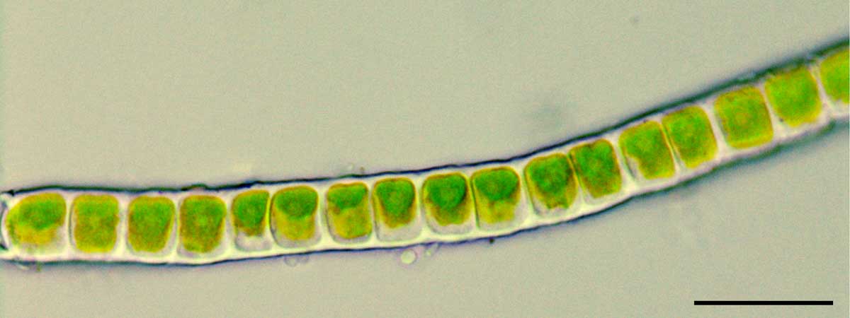 クレブソルミディウム（Klebsormidium sp.）の画像